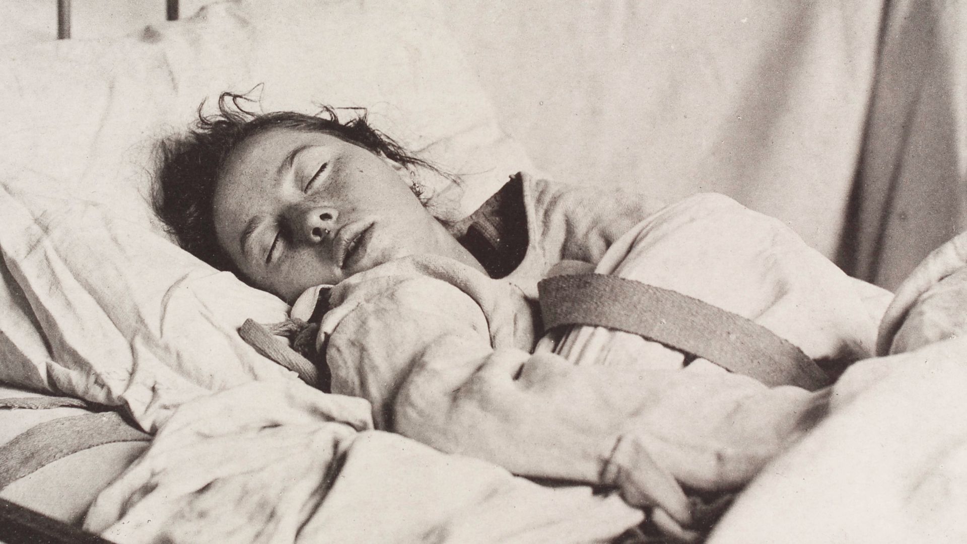 20 Historical Diseases That Disappeared Without Explanation