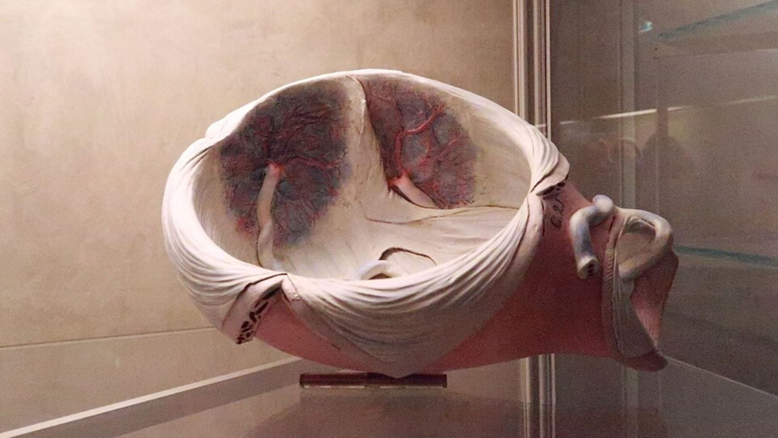 13. Doctors Thought The Womb Wandered The Body Looking For Trouble