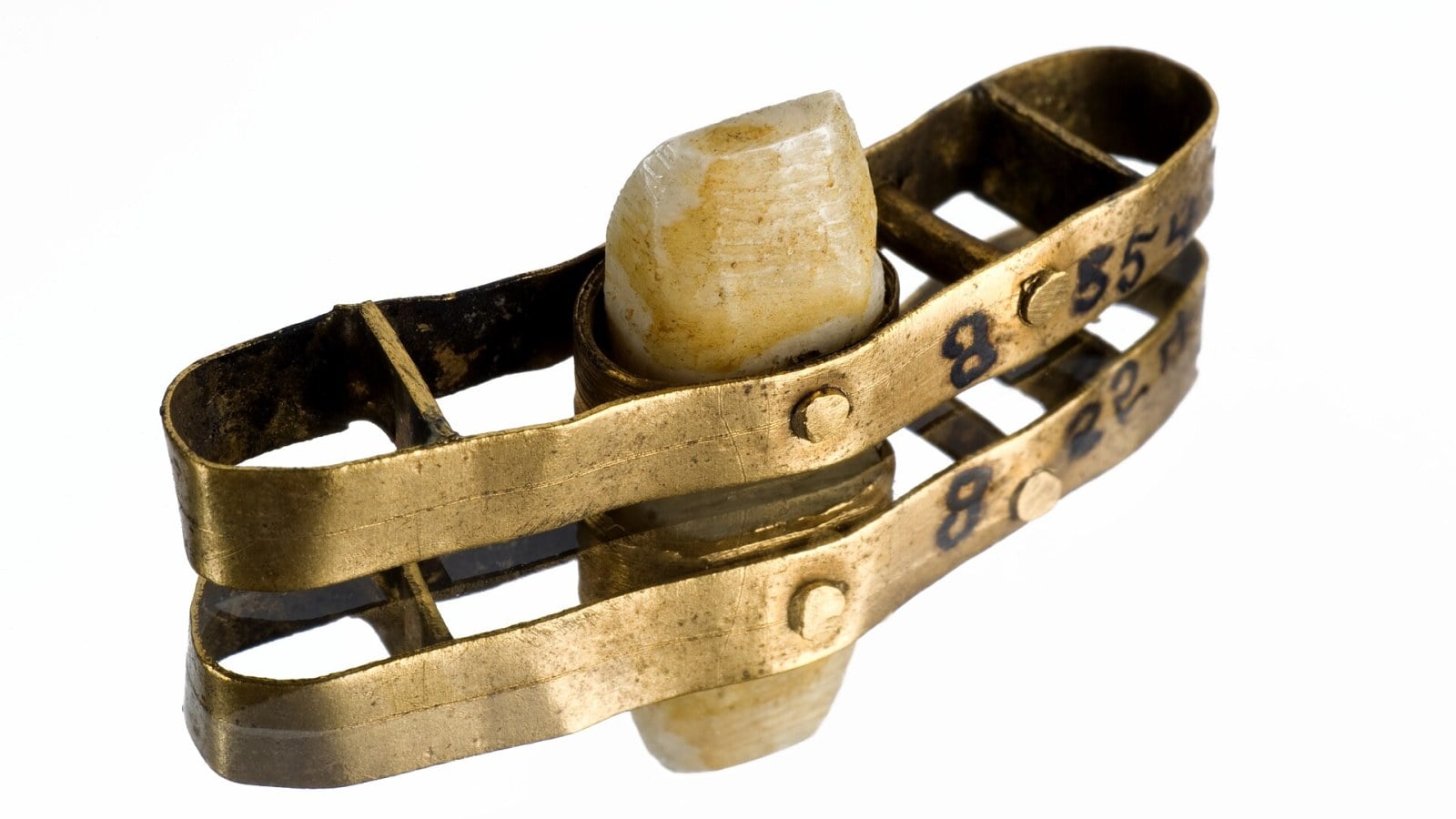 4. You Couldn't Bury Gold, Except In Your Teeth
