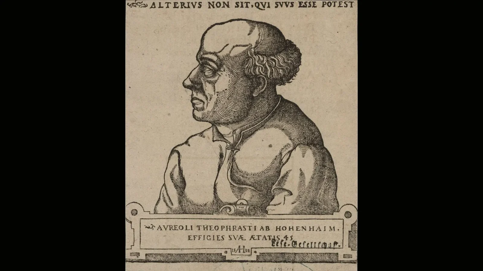18. Paracelse voulait que la pierre guérisse les gens