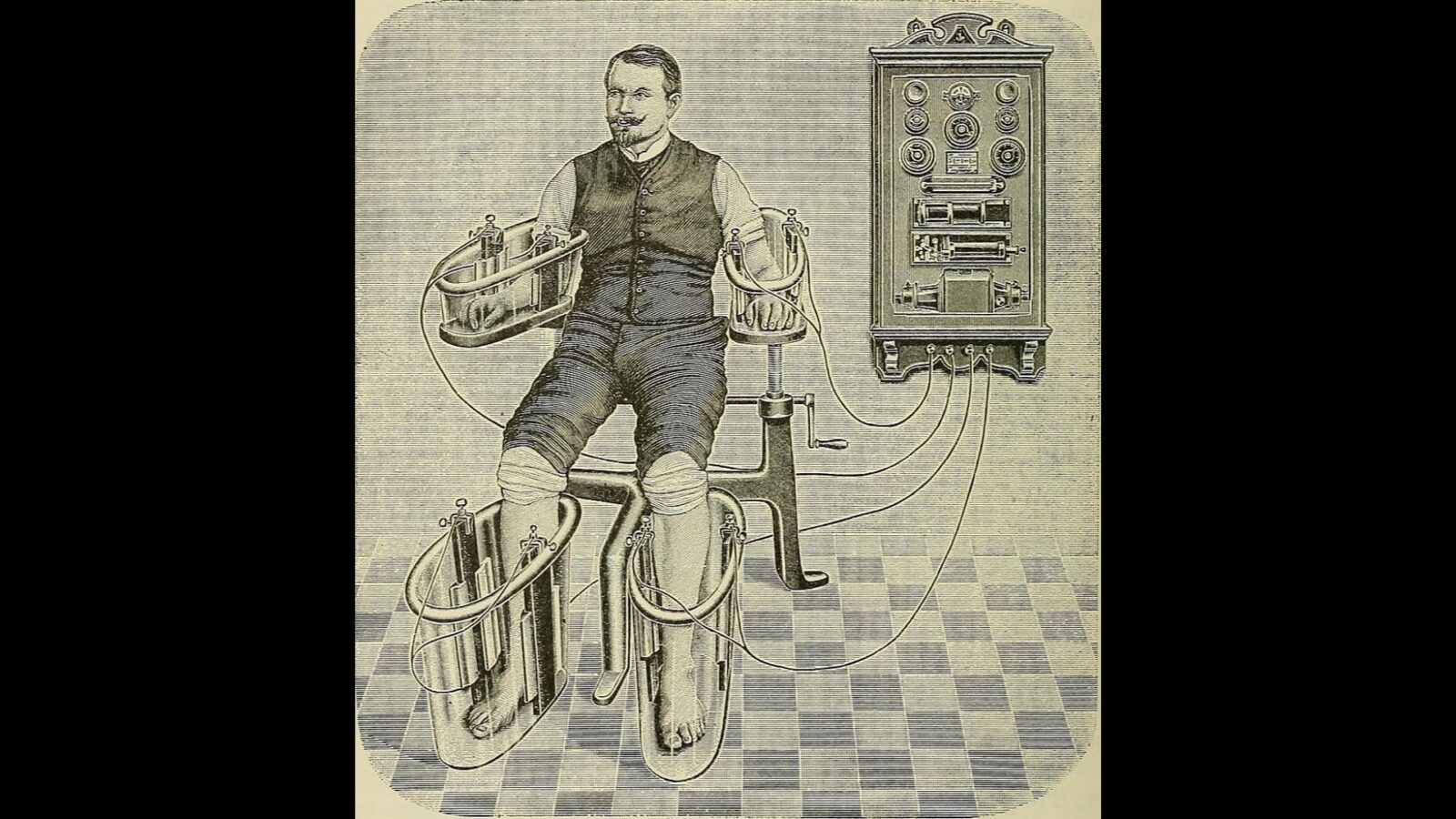 17. The Four-Cell Bath Aimed Current At One Limb At A Time