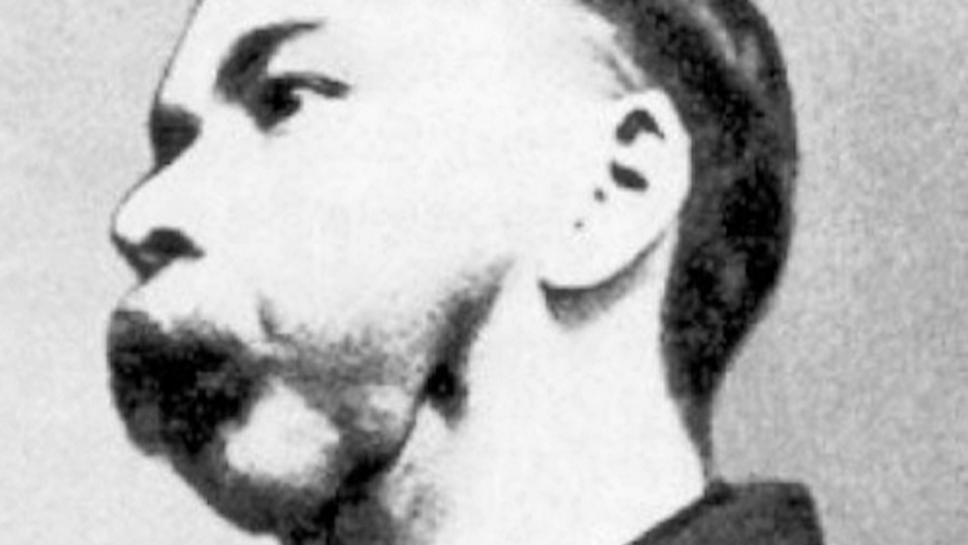 15. Phossy Jaw