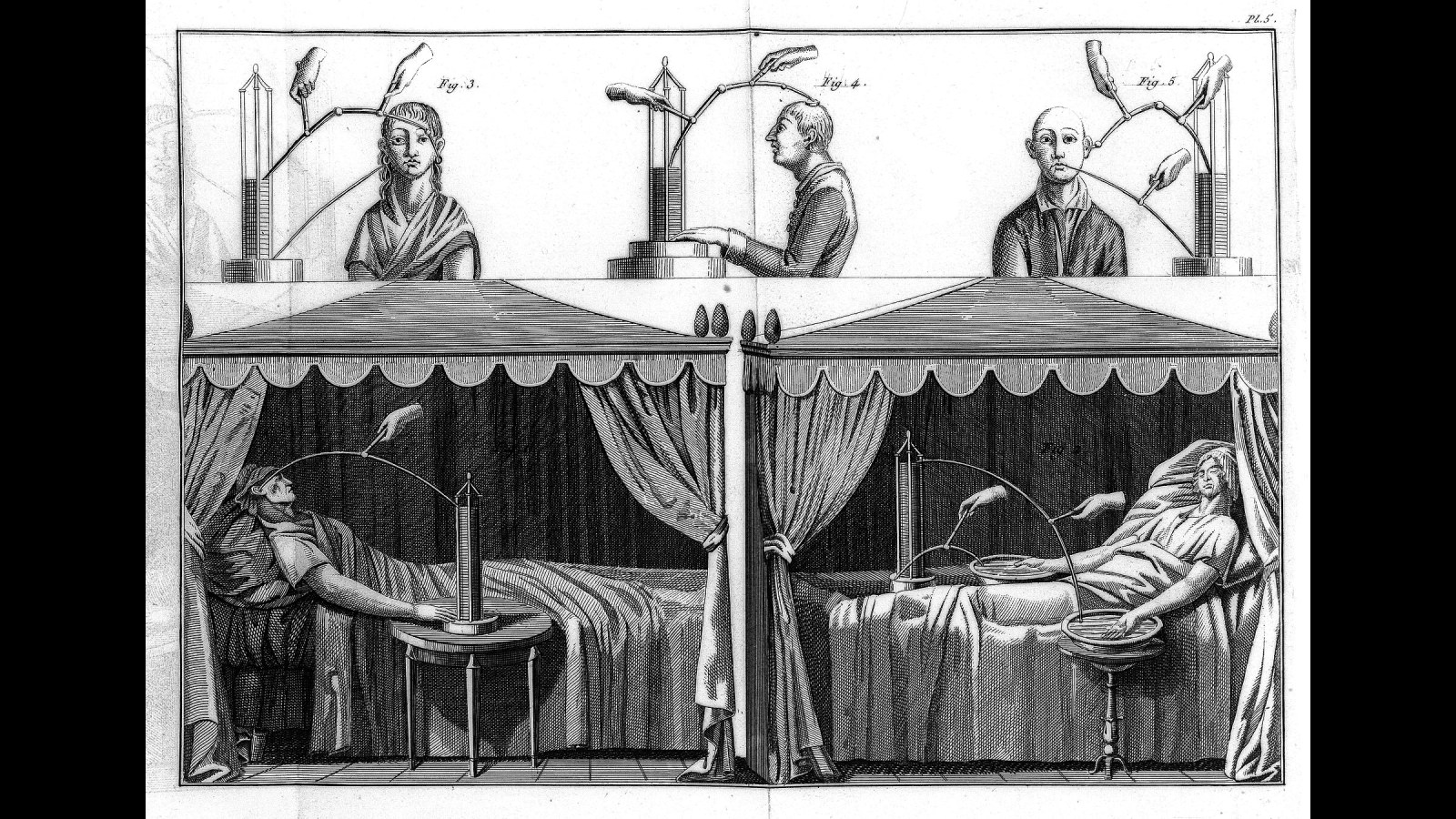 4. A Hanged Man's Corpse Twitched, And Frankenstein Was Born
