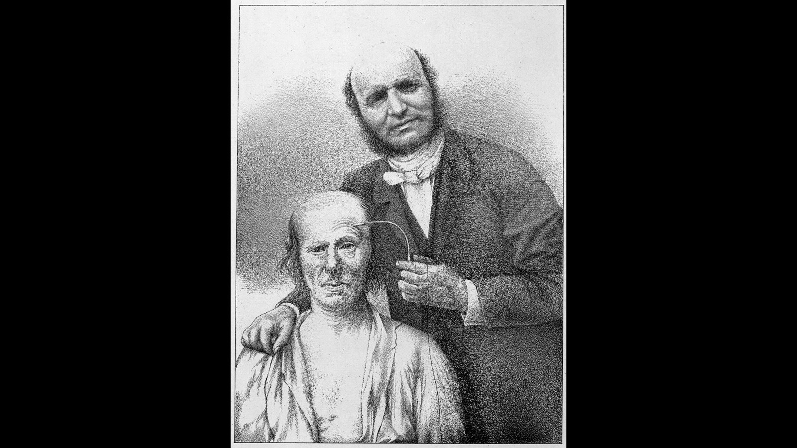 7. Duchenne Mapped The Human Face With Real Current