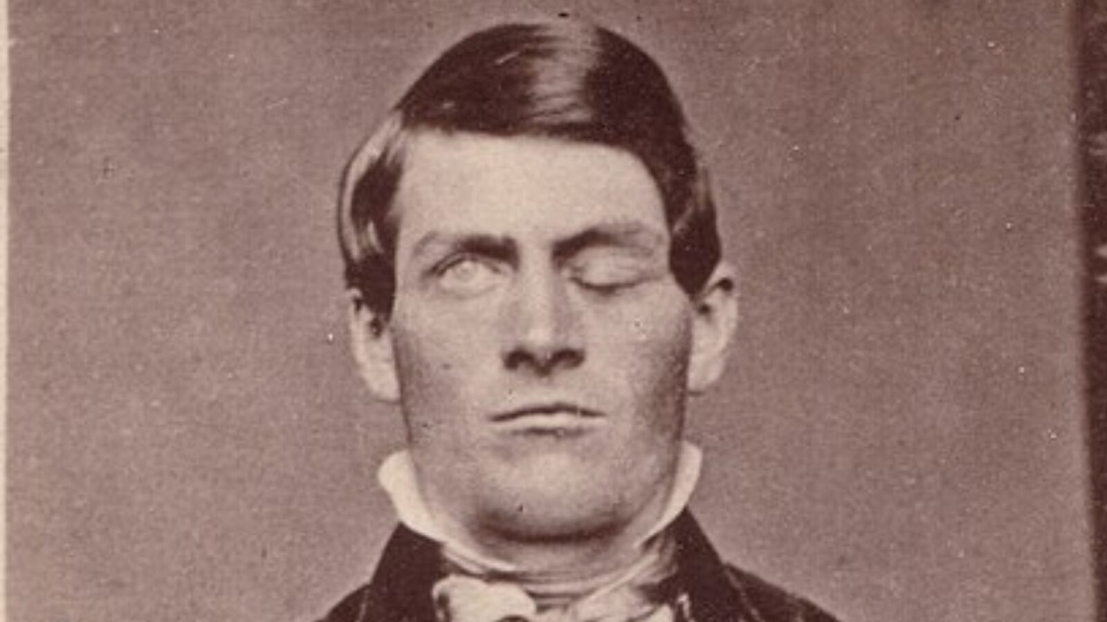 11. Phineas Gage s'est fait transpercer le crâne par une tige de fer