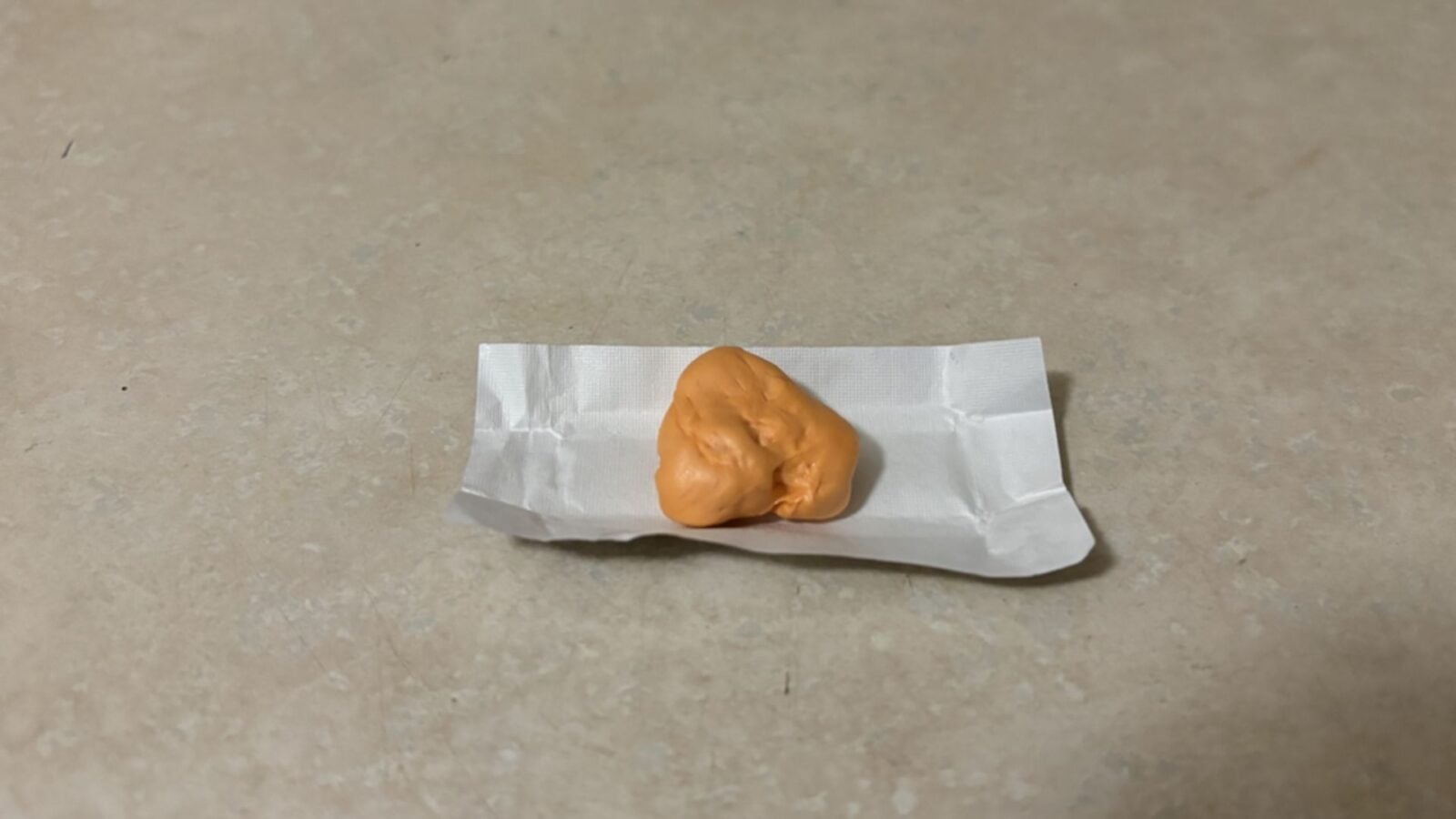 16. Gum Turned Into Flesh