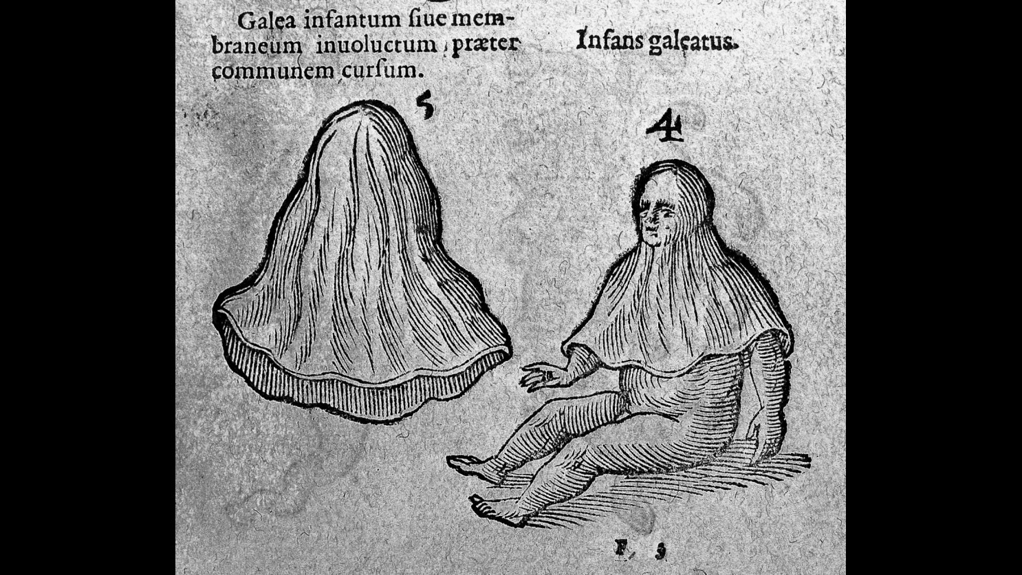 4. A Birth Caul Was Tucked In As A Lucky Charm