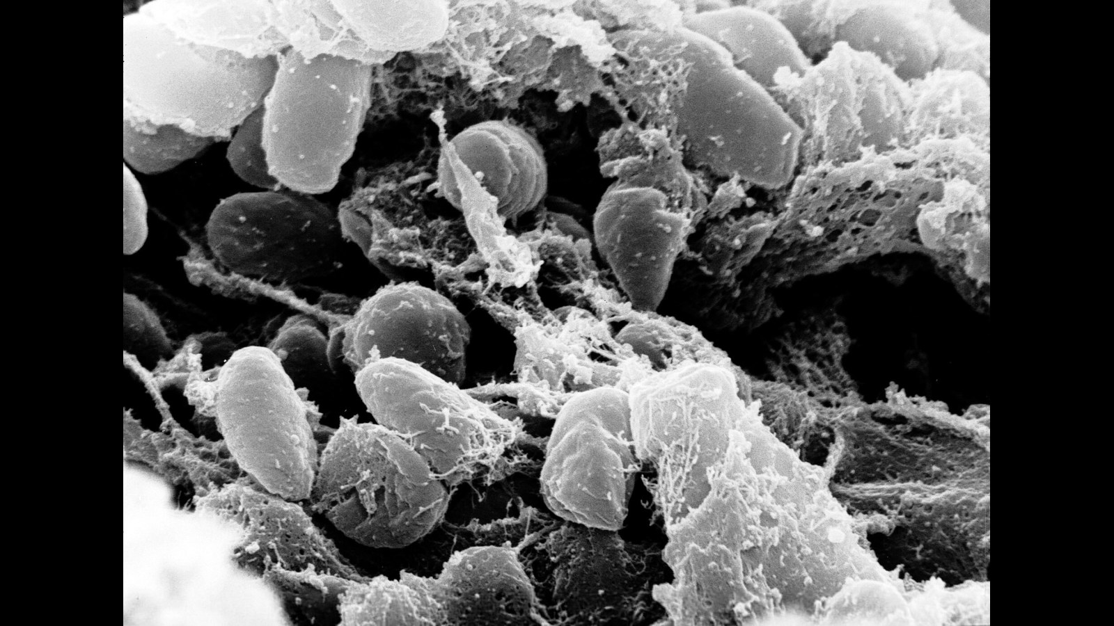 10. L'ADN ancien a permis de déterminer la véritable cause de la peste noire