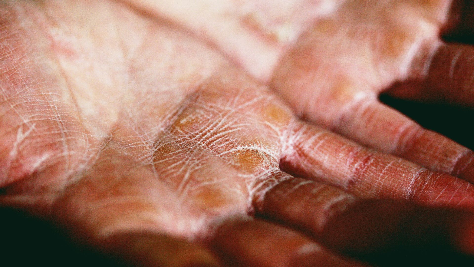 6. Peau sèche