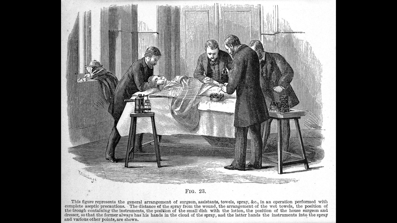 18. Traditionalist Doctors Mocked Joseph Lister's Carbolic Spray As Pointless