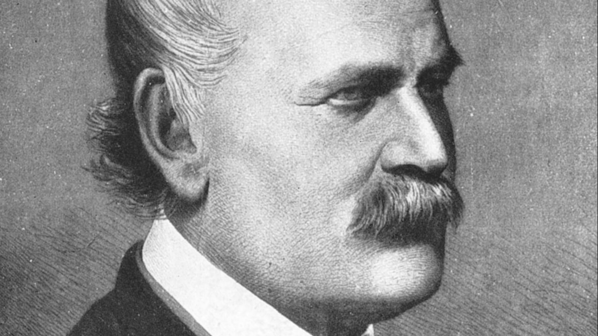 4. Ignaz Semmelweis, chassé de la médecine sous les railleries